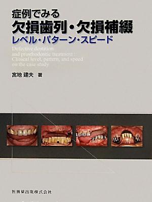 楽天ブックス: 症例でみる欠損歯列・欠損補綴 - レベル・パターン