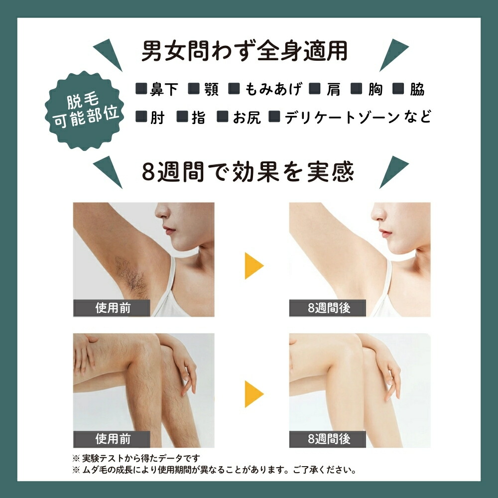 楽天市場】楽天ランキング1位獲得 脱毛器 AURORA オーロラ グリーン