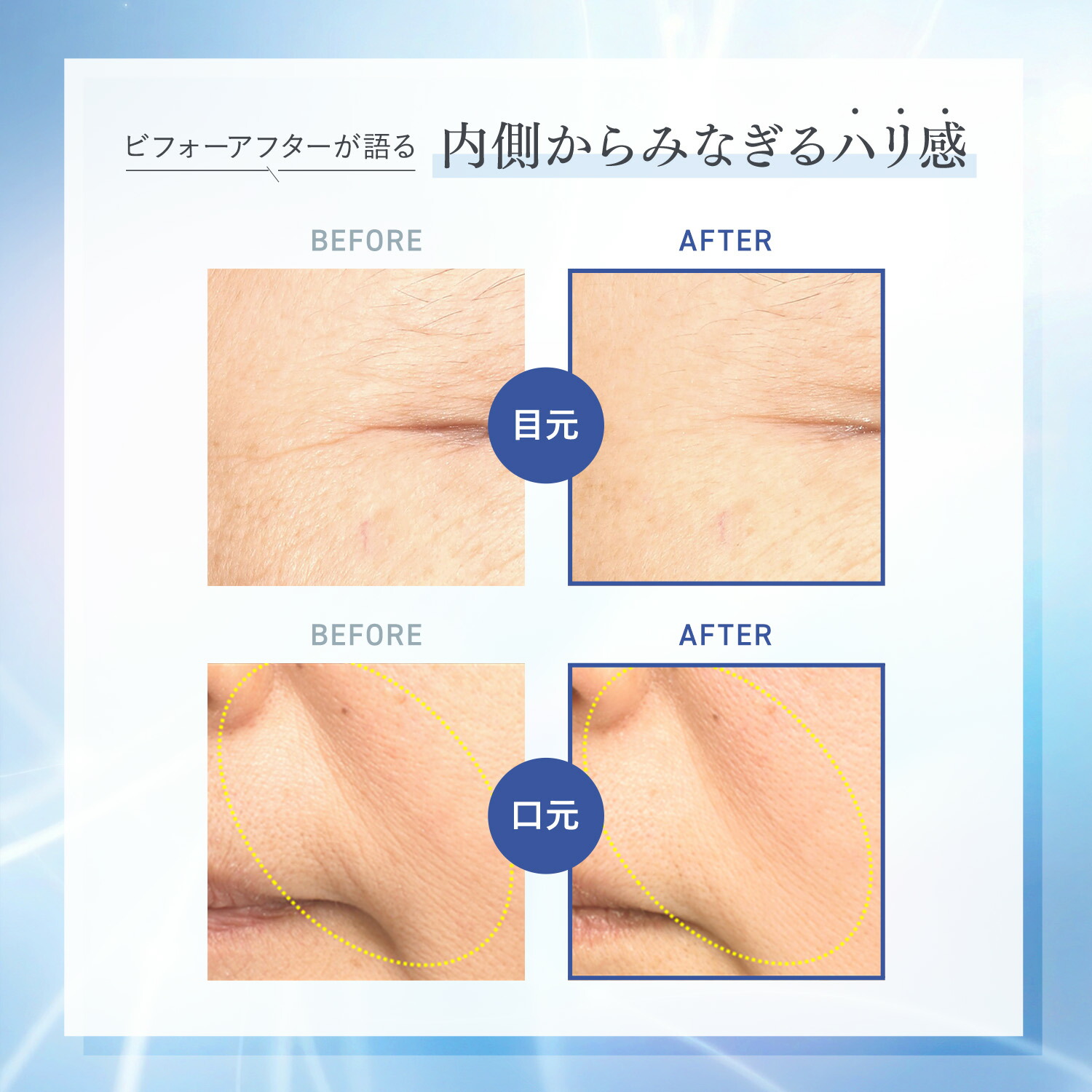 楽天市場】サインズエフェクター＜医薬部外品＞【ファンケル 公式