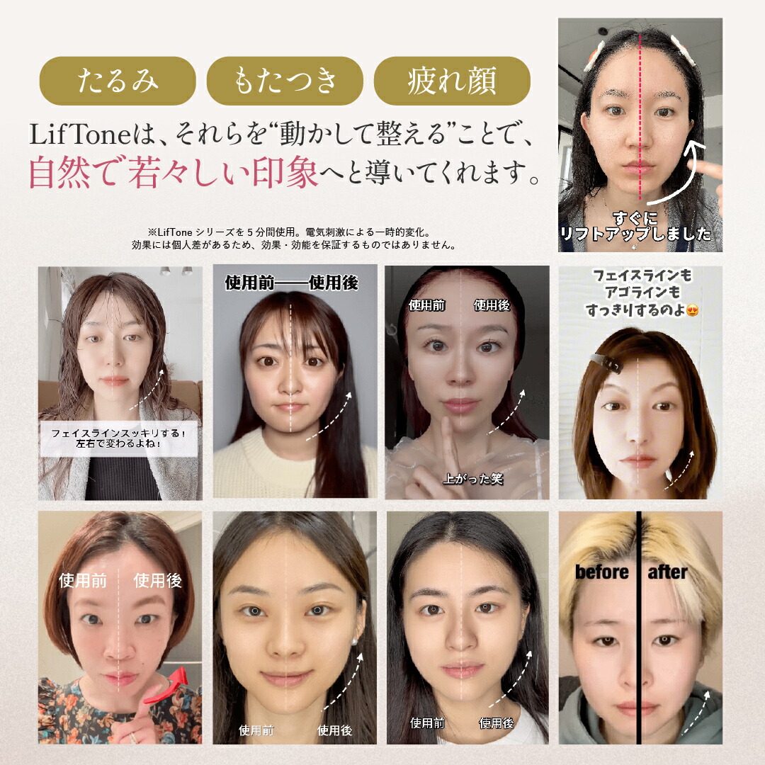 楽天市場】[特許取得済!][正規代理店] 保証1年 EMS 美顔器 トータル