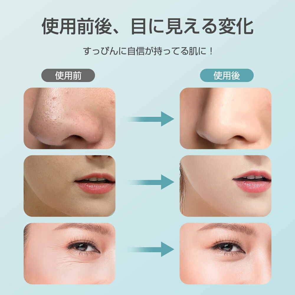 楽天市場】楽天1位 美顔器 超音波美顔器 全身防水 顔 ケア 超音波 美肌