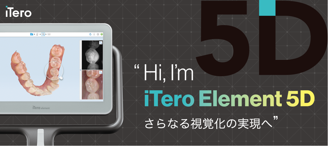 Expand your possibilities – iTero エレメント5Dプラスで広がる可能性