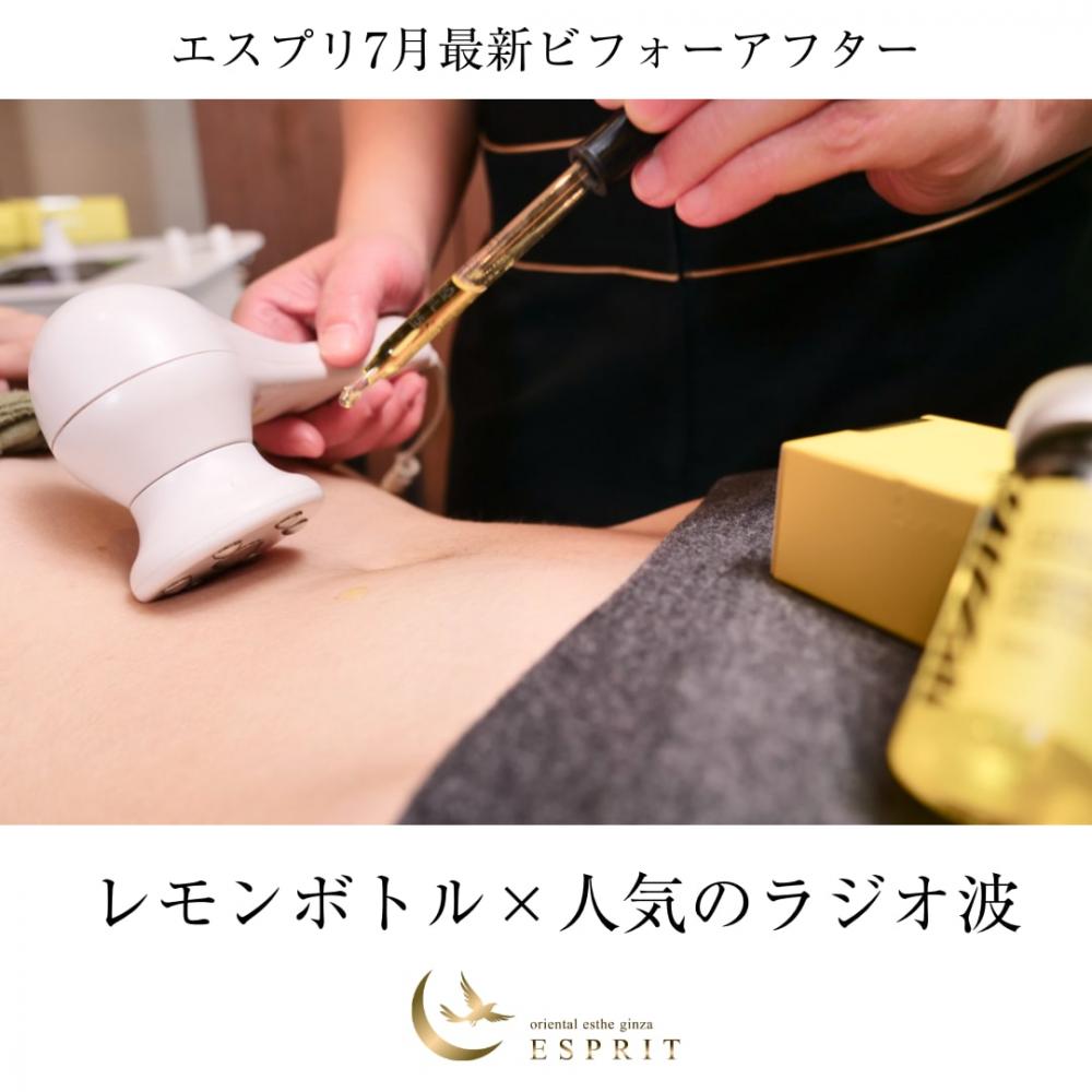 東京で話題！【レモンボトル×人気のラジオ波】2025年7月痩身エステの