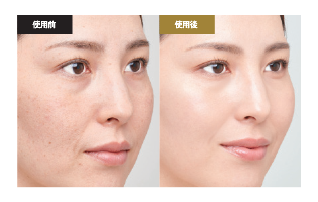 イミニ 公式サイトイミニ 薬用リンクル美白クッション セット