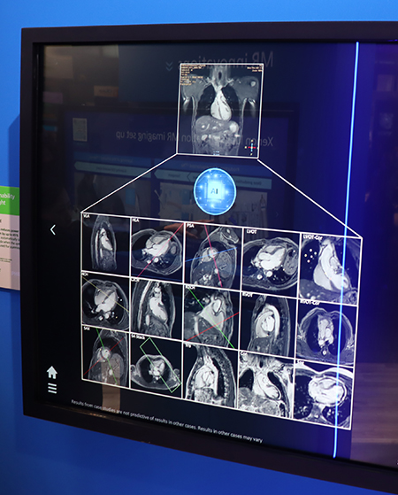 RSNA2025 フィリップス：MRI：世界初の3.0TヘリウムフリーMRI
