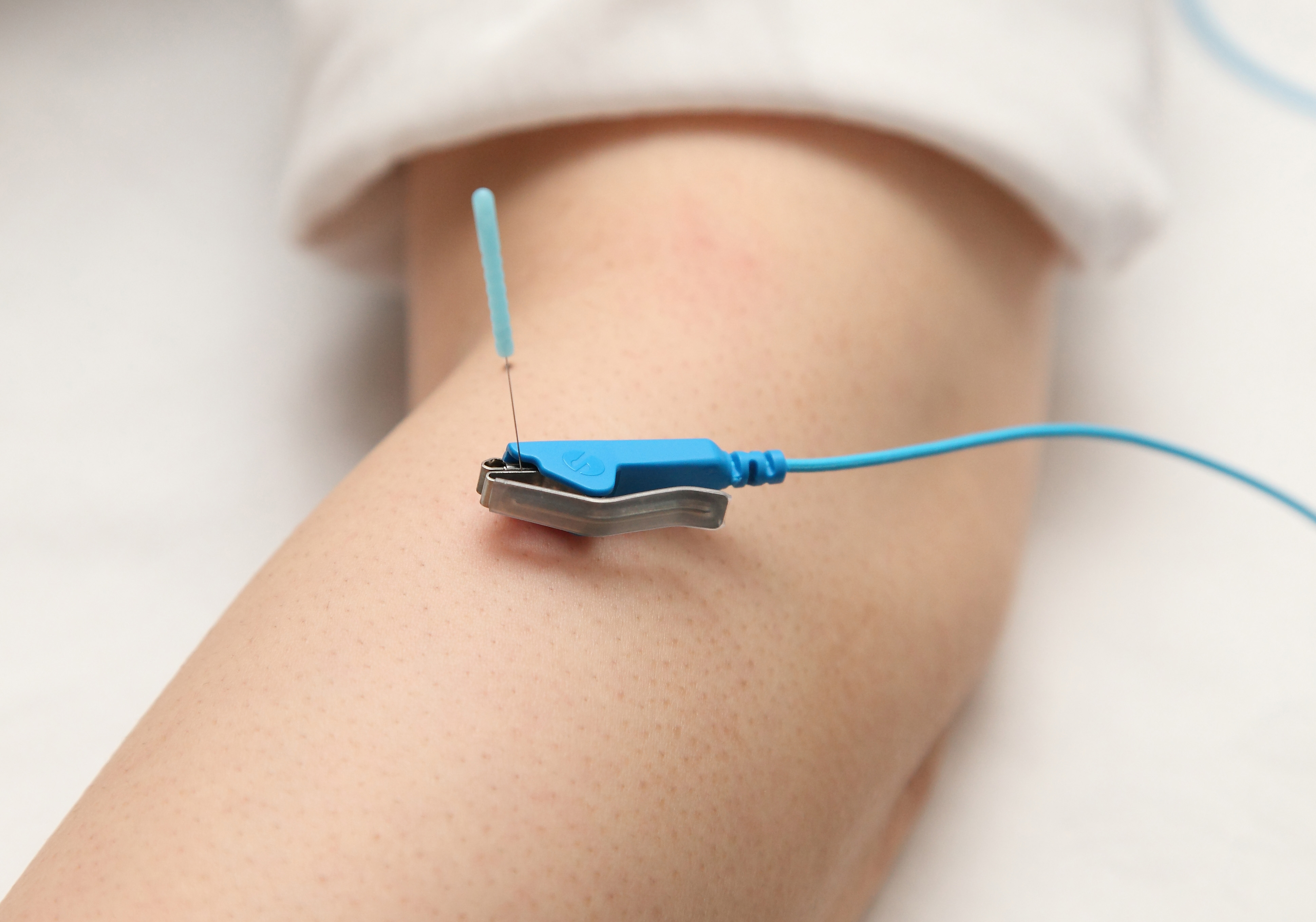 picorina ピコリナ 鍼電極低周波治療器 - ニットクSHOP