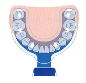 振動型アライナーフィッティング装置「VPro」を新たに導入しました