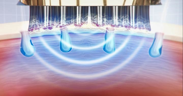 ヴェーダスカルプブラシ｜YA-MAN PROFESSIONAL (ヤーマン