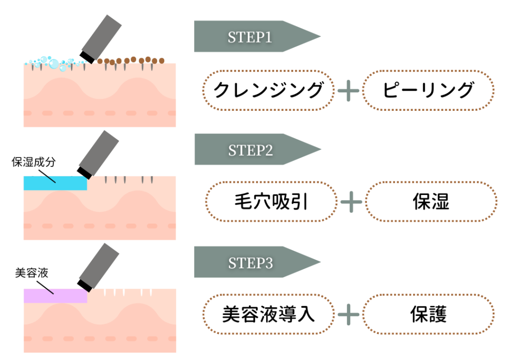 ハイドラフェイシャル｜毛穴の黒ずみ・毛穴洗浄｜広島 ヤヨイ
