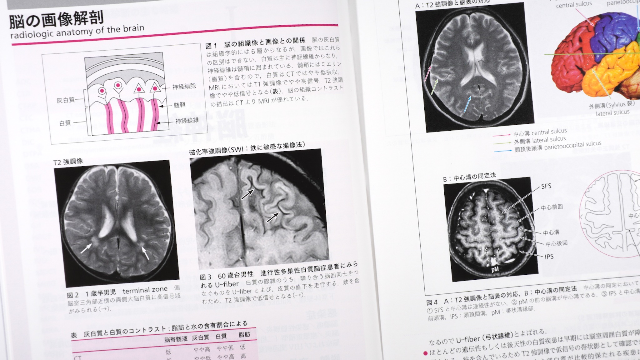 ジェネラリストを目指す人のための画像診断パワフルガイド 第2版