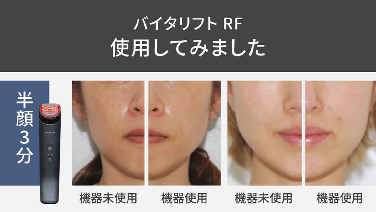 プロがパナソニック「バイタリフト RF」を実機検証！口コミの実態を