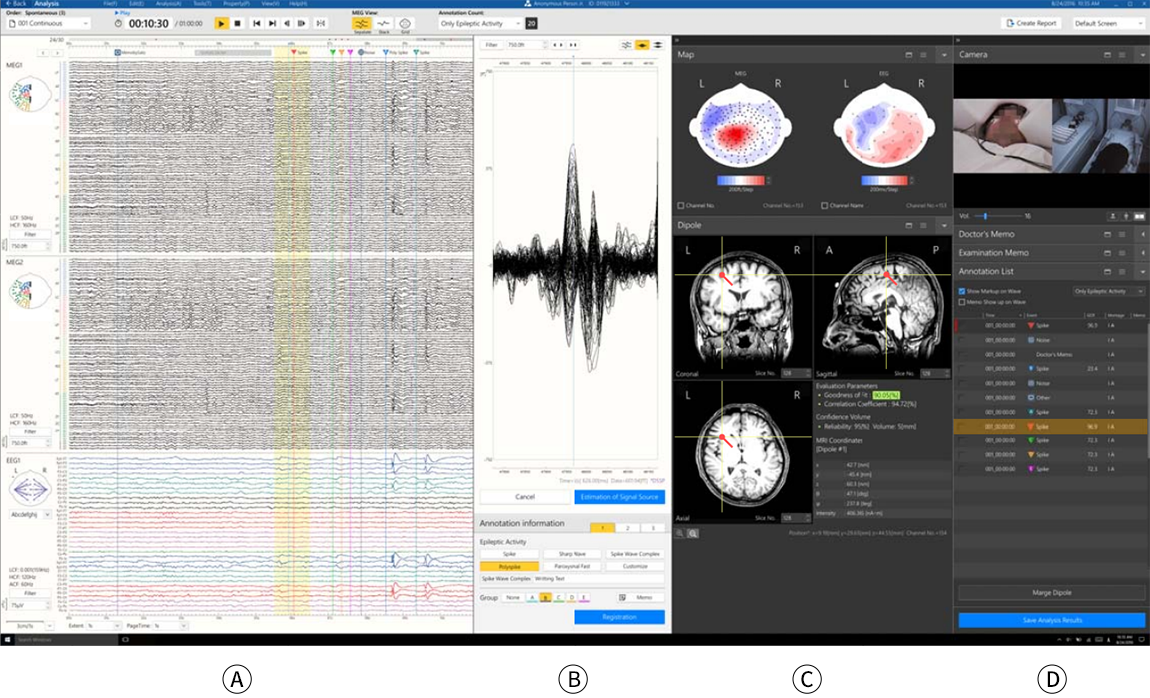医療現場に寄り添うデザイン | リコーグループ 企業・IR | リコー