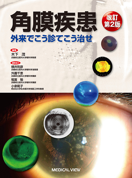 m3電子書籍 | 眼手術学 7 網膜・硝子体I