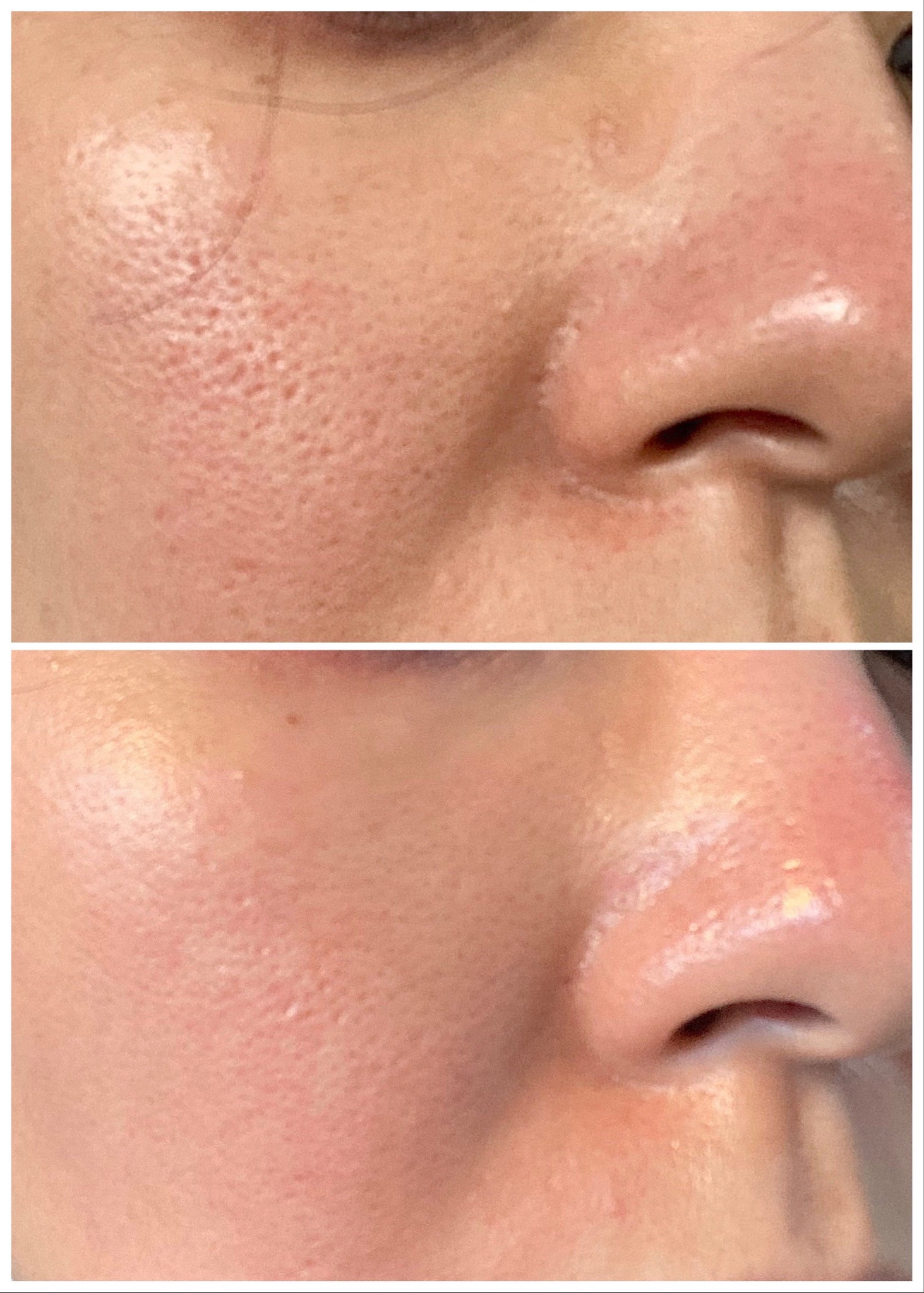 トリア / トリア・スムーズビューティの公式商品情報｜美容・化粧品