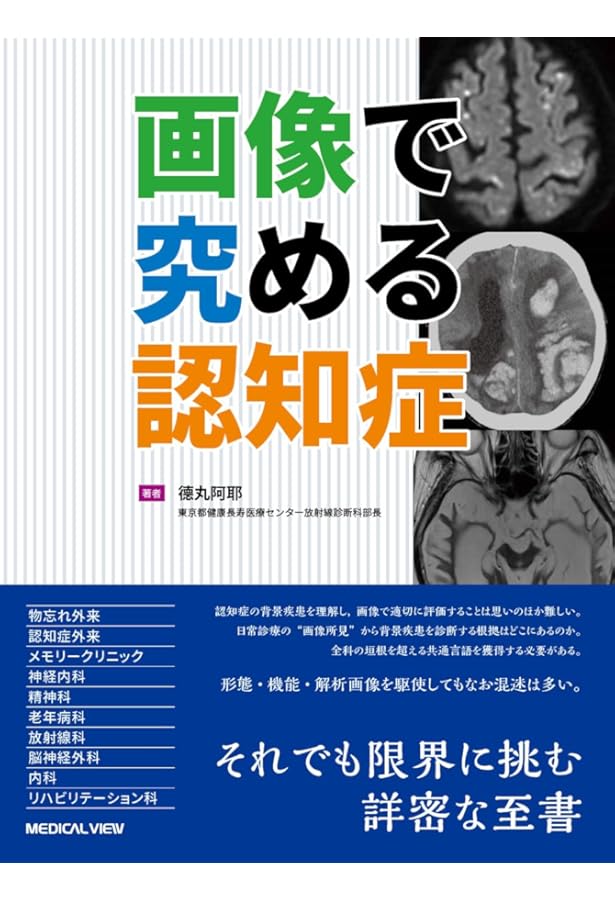同一症例の経過・画像・病理で紐解く 臨床神経病理ワールド | 宇高不可