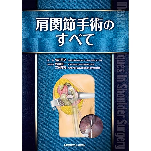 肘関節手術のすべて | 今谷 潤也, 秋田 恵一, 二村 昭元 |本 | 通販
