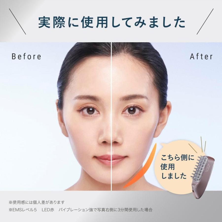 スカルプD ボーテ 即納 医師監修 ANGFA アンファー スカルプ電気ブラシ