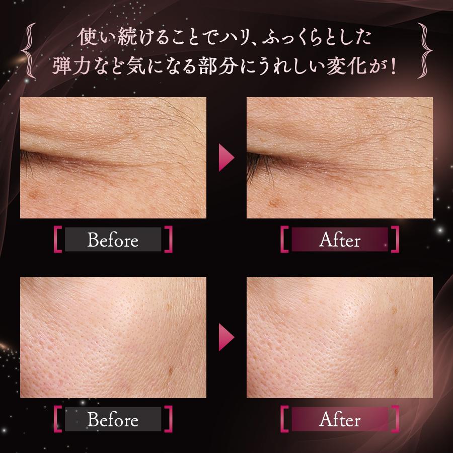 FANCL（ファンケル） アドバンスト ビューティ コンセントレート