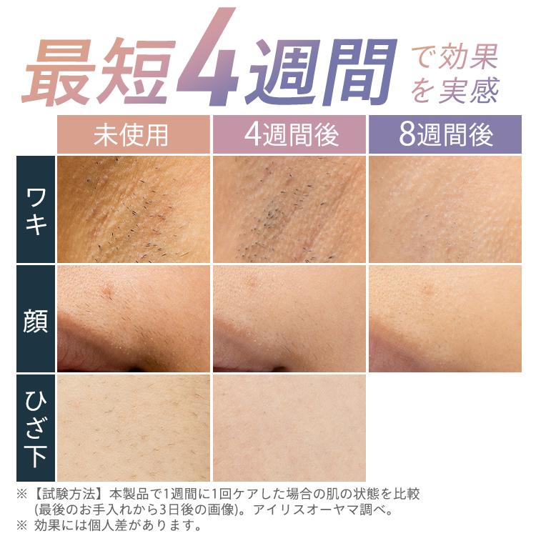 IRIS OHYAMA（アイリスオーヤマ） 脱毛器 メンズ 光美容器 ミコラ