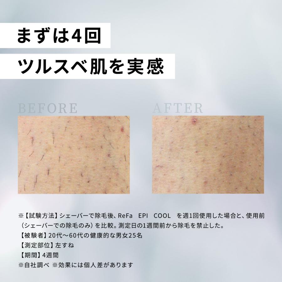 ReFa（リファ） ○公式ストア○ エピ クール 光美容器 公式 ムダ毛