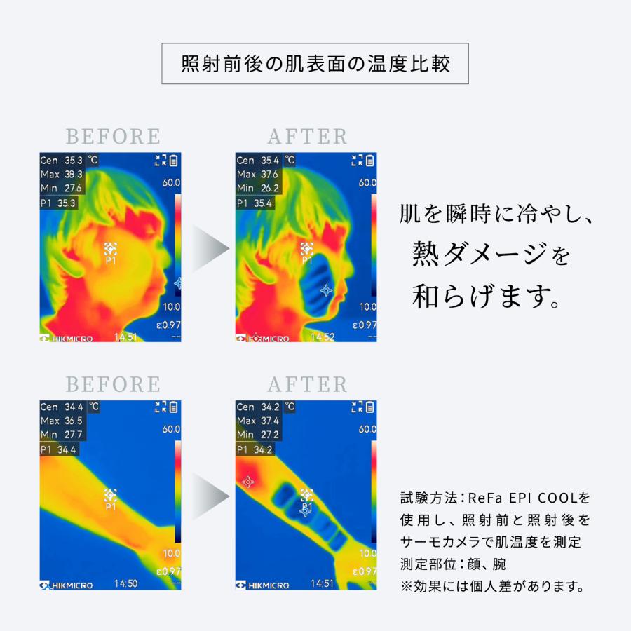ReFa（リファ） ○公式ストア○ エピ クール 光美容器 公式 ムダ毛