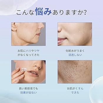 COSBEAUTY プラズマ美顔器RISE R1 Air : sun lise - 通販 - Yahoo