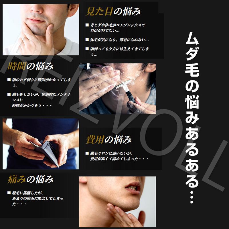 IPL光脱毛器 1年保証 痛くないハイパワー家庭用全身脱毛機で自宅を