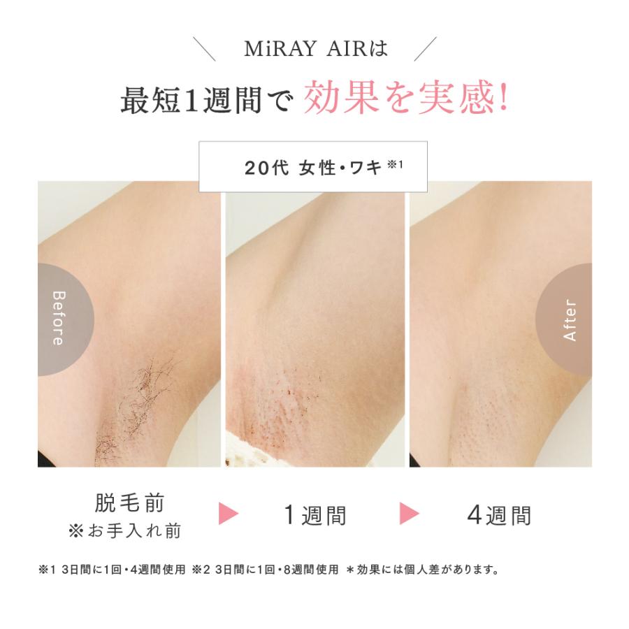 MYTREX（マイトレックス） 脱毛器 公式 MiRAY AIR 光美容器 ムダ毛ケア