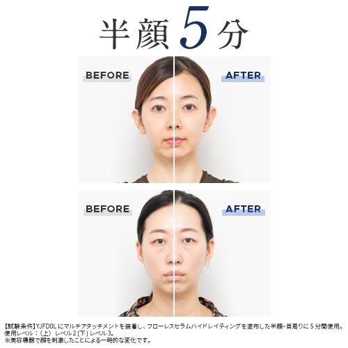 YA‐MAN（ヤーマン） ブラシ 美顔器 ハイパーフェイスリフトブラシ 公式