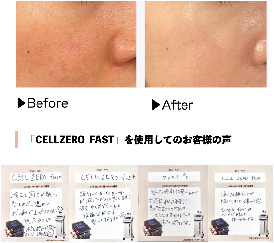 CELLZERO FAST コンパクトボディーに6機能搭載 ｜ 定額制セルフエステ