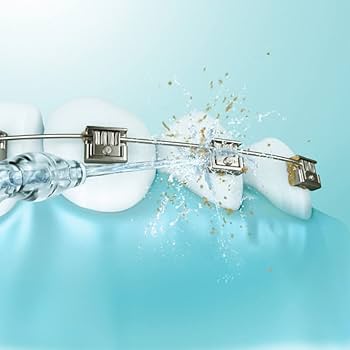 Amazon.co.jp: Spryaut 交換 超音波水流ノズル for Panasonic