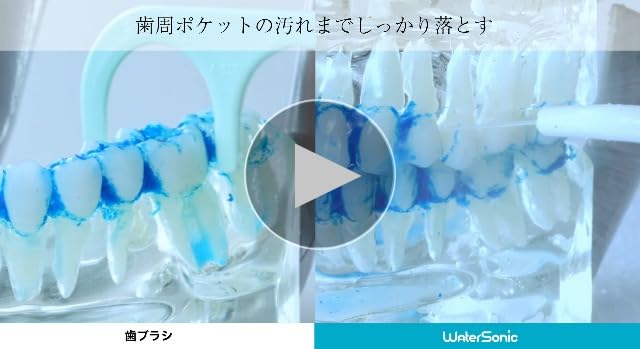 Amazon.co.jp: Water Sonic ウォーターソニック 【歯科大学共同研究 歯