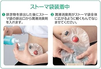 Amazon | デオファイン潤滑消臭剤 20881 250ML ボトル ストーマケア