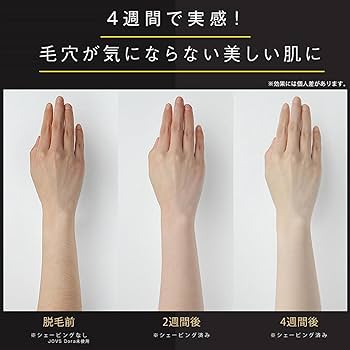 Amazon.co.jp: JOVS Dora J847モデル 脱毛器 家庭用 光美容器 VIO対応