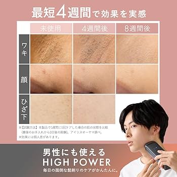 Amazon | 【MiCOLA】アイリスオーヤマ 脱毛器カテゴリ 光美容器 メンズ