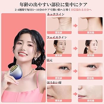 Amazon.co.jp: Redfire 美顔器【2024年業界最新スタンプ式RF美顔器