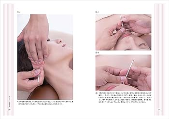 Amazon.co.jp: てい鍼テクニック 美容編 －船水隆広のTST2－ : 船水