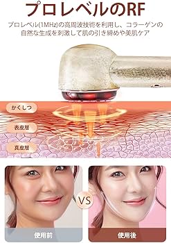 Amazon.co.jp: 美顔器 EMS美顔器 1台数役 RFラジオ波 イオン導入