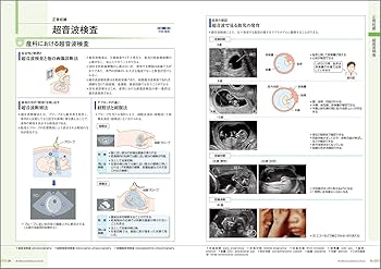 病気がみえる vol.10 産科 第4版 | 医療情報科学研究所 |本 | 通販