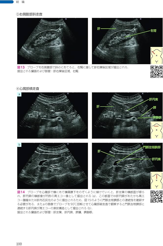 Dr 森の腹部超音波診断パーフェクト premium movie version 改訂第2版