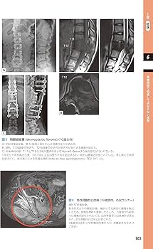 整形外科医のための脊椎のスポーツ診療のすべて ─ 電子版付 ─ | 加藤