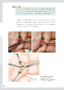 整形外科レジデントのためのベーシック手術 【上肢・脊椎・下肢 3冊合