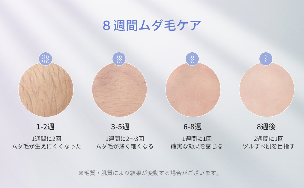 Amazon | 脱毛器 vio対応 COSBEAUTY 家庭用脱毛器 エステ技術採用 脱毛