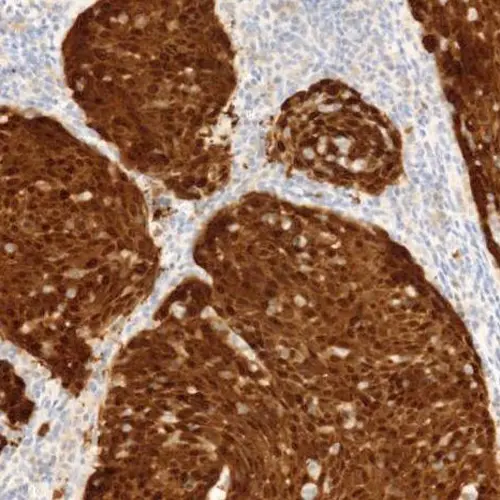 p16 Antibody (INK4a) - IHC Primary Antibodies