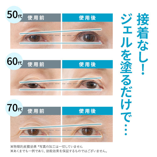 北の快適工房 【爆買WEEKセール!】公式 リッドキララ 3個セット まぶた