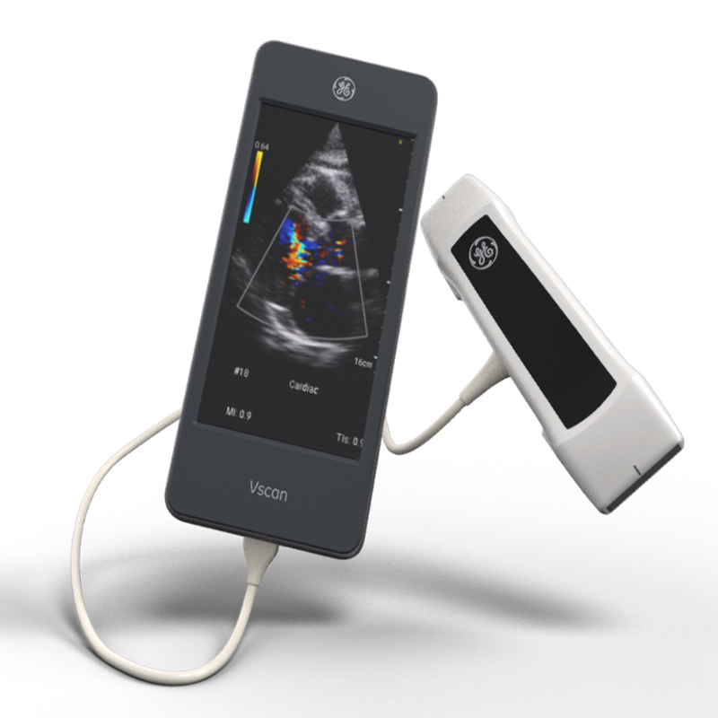 Vscan Extend Doppler, Ultrasound, Accessories and Demo – Stat