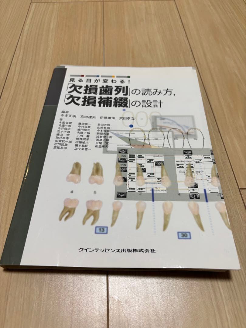 裁断済】見る目が変わる！ 「欠損歯列」の読み方，「欠損補綴」の設計