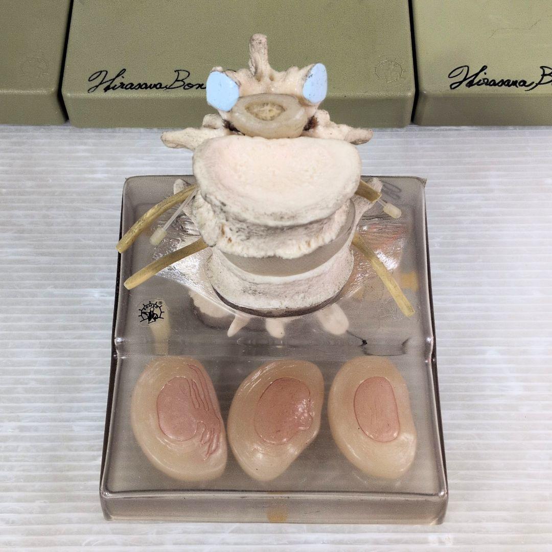 SOMSO 肩関節 膝関節 肘関節 椎間板 模型 ソムソ ドイツ製 人体模型