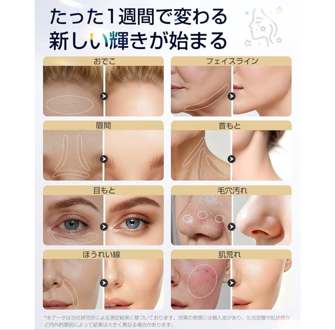 2026最新 1台18役 美顔器 RF ラジオ波 EMS 温冷ケア リフトアップ