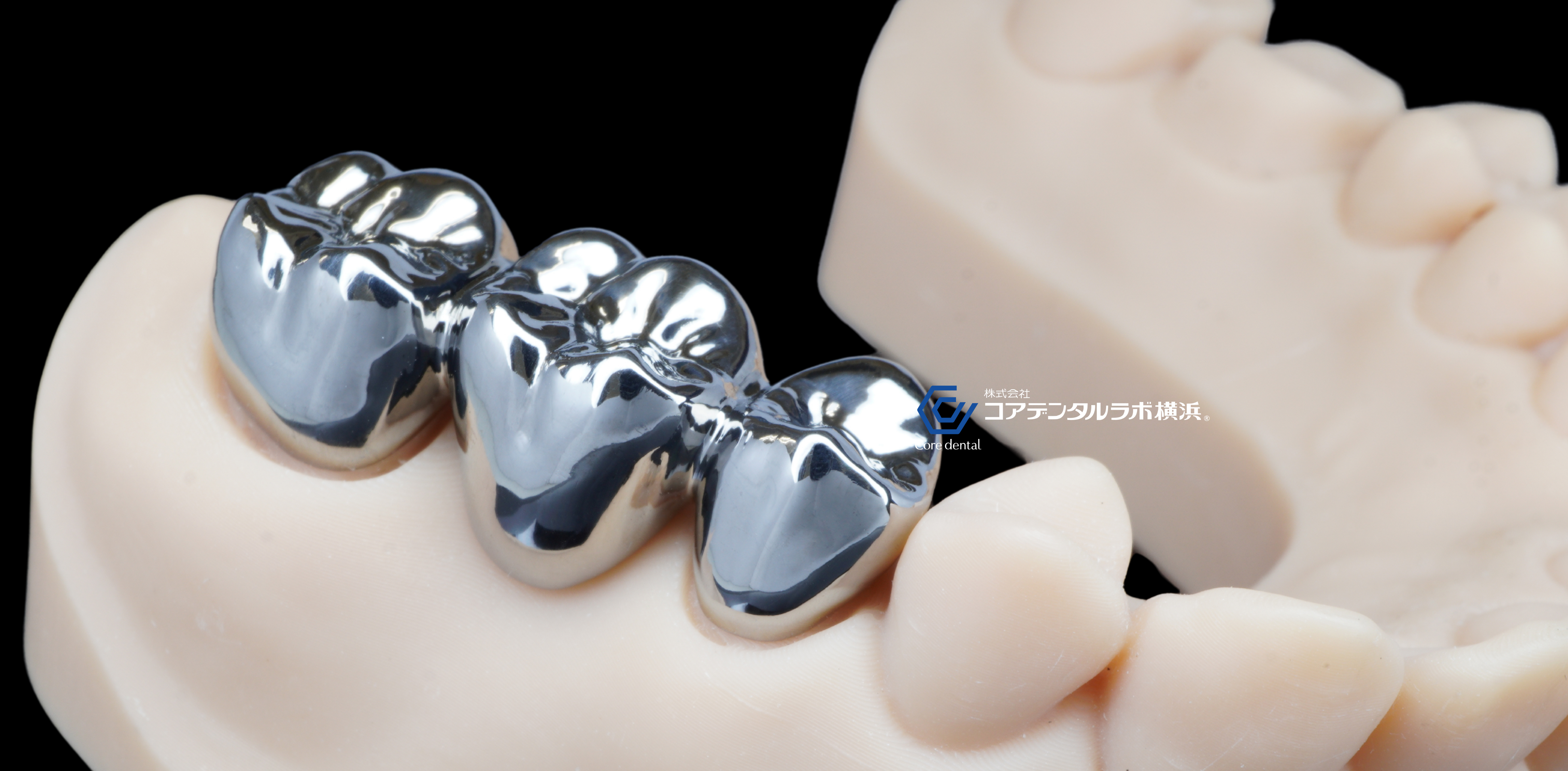チタンクラウン | コアデンタルラボ横浜 特設サイト
